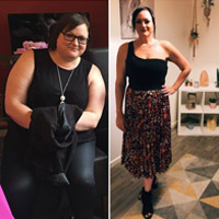 Gastric Bypass Gave Me the Confidence to Go Forward and My Life Back.